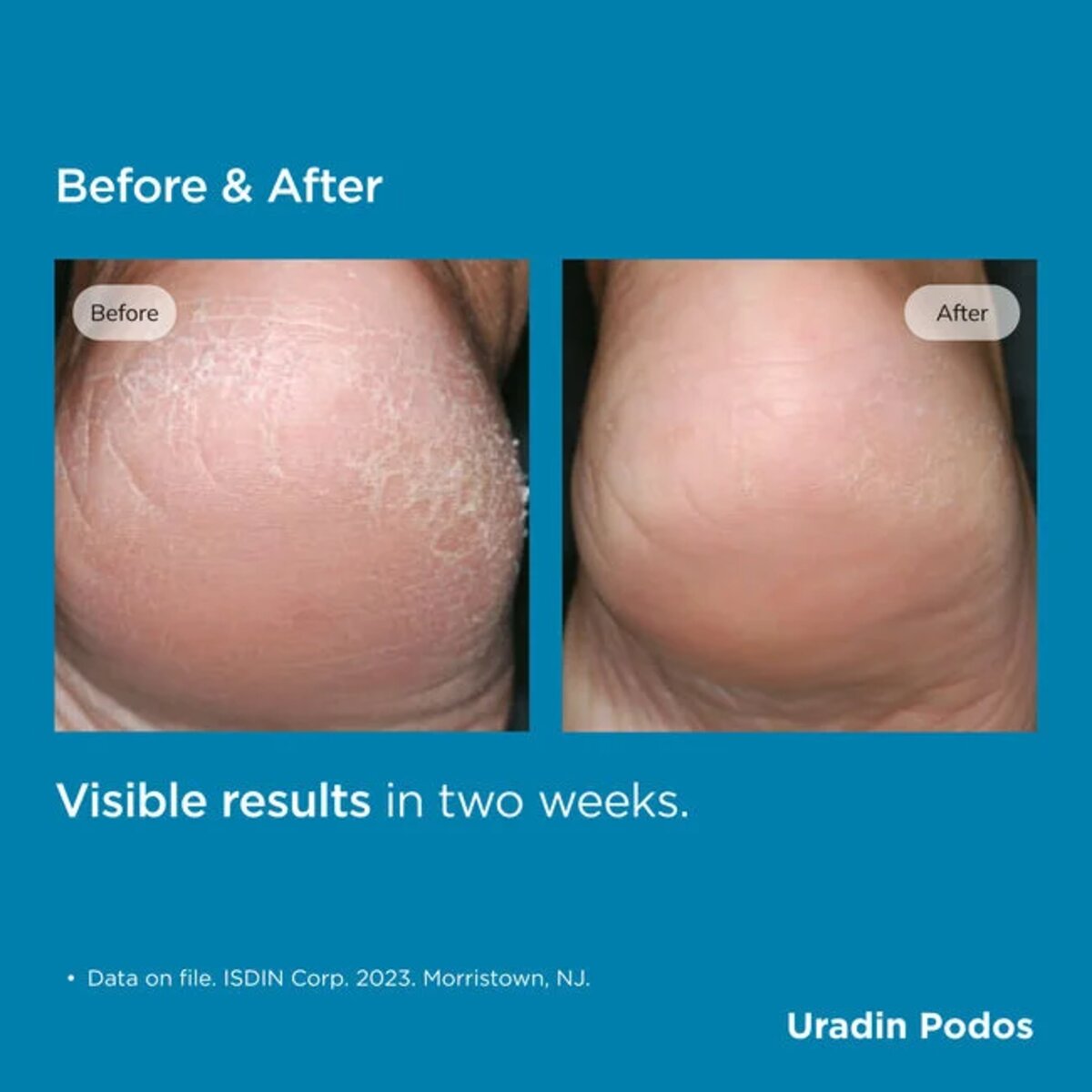 ISDIN Uradin Podos