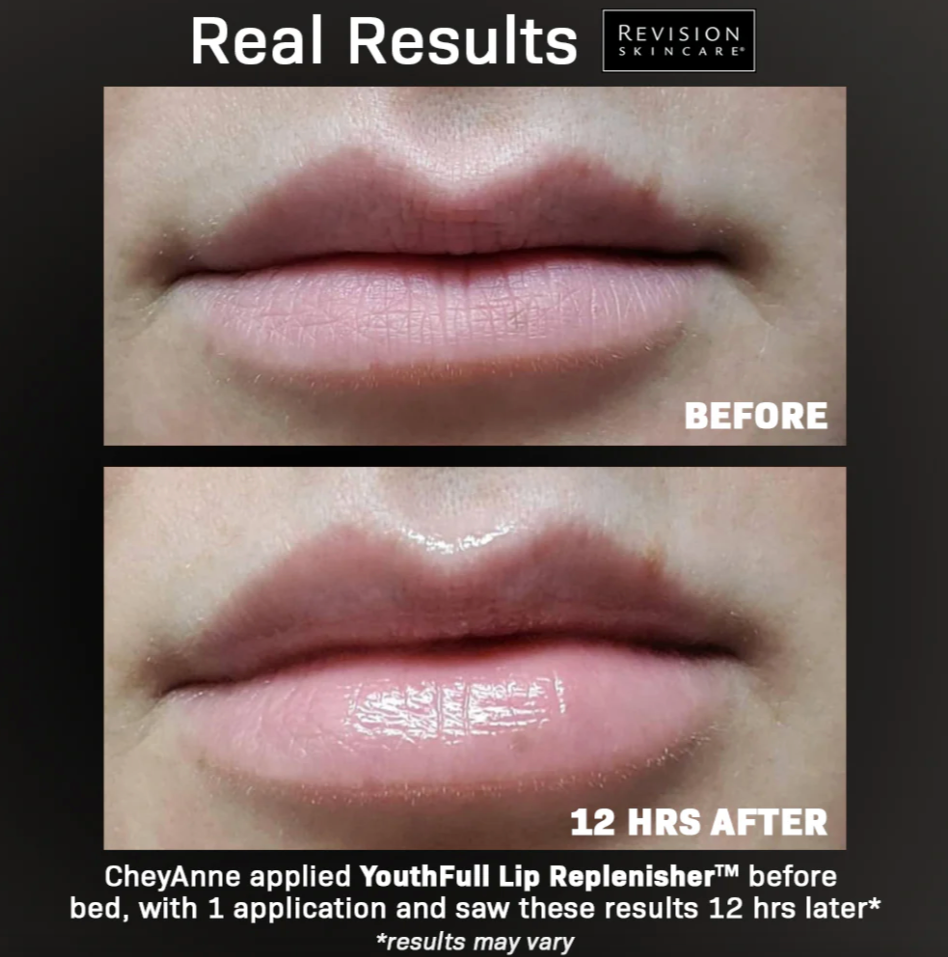 Revision Youthfull Lip Replenisher