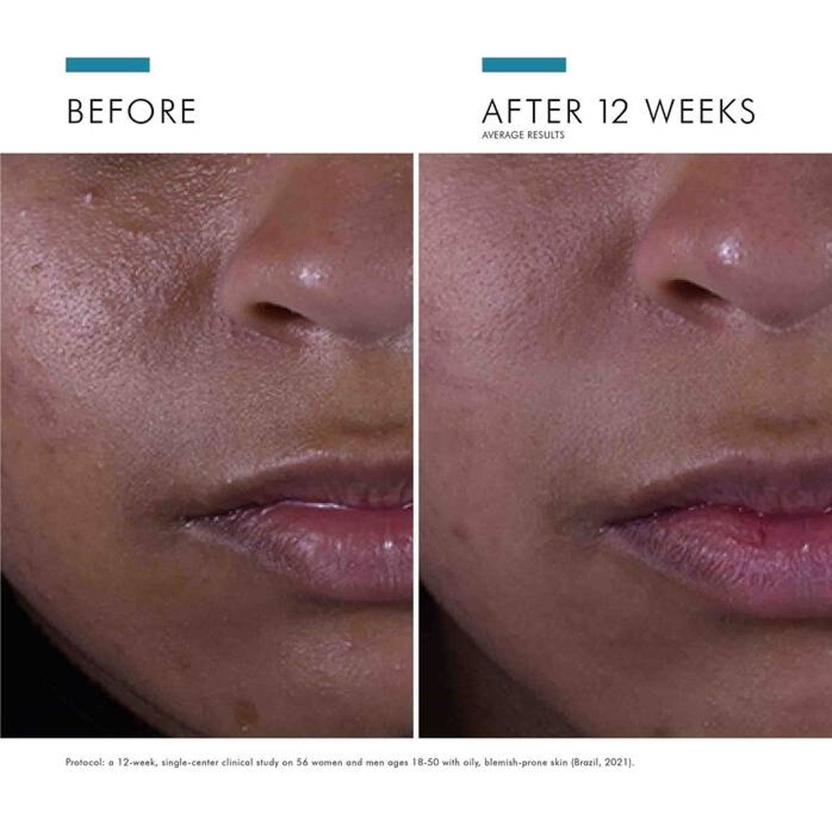 Skinceuticals SILYMARIN CF