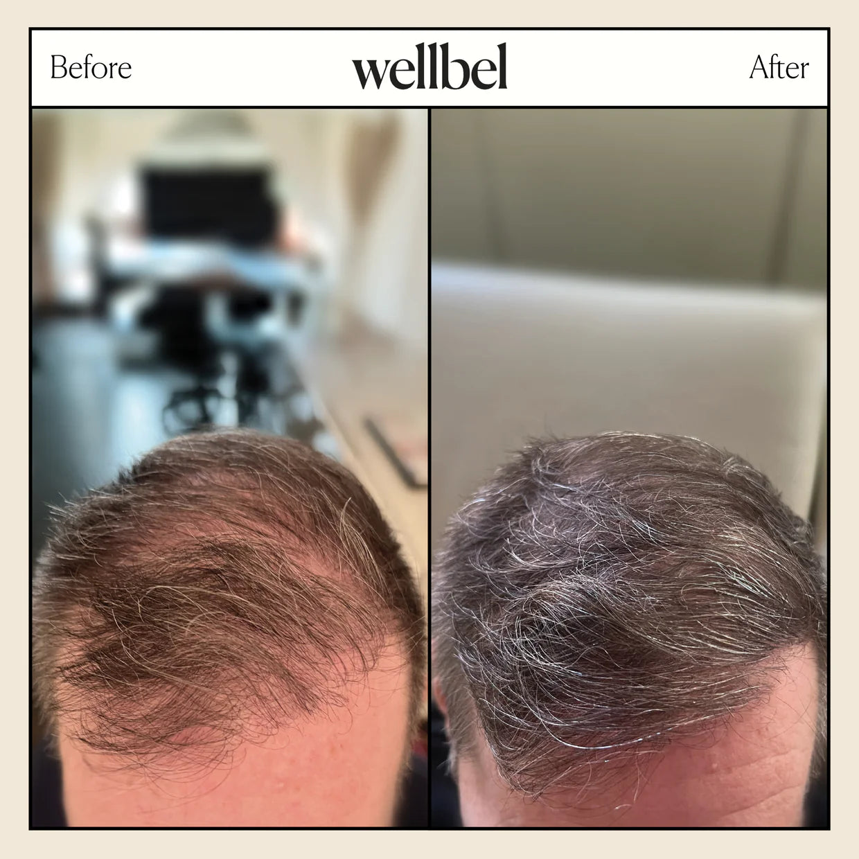 Wellbel Men