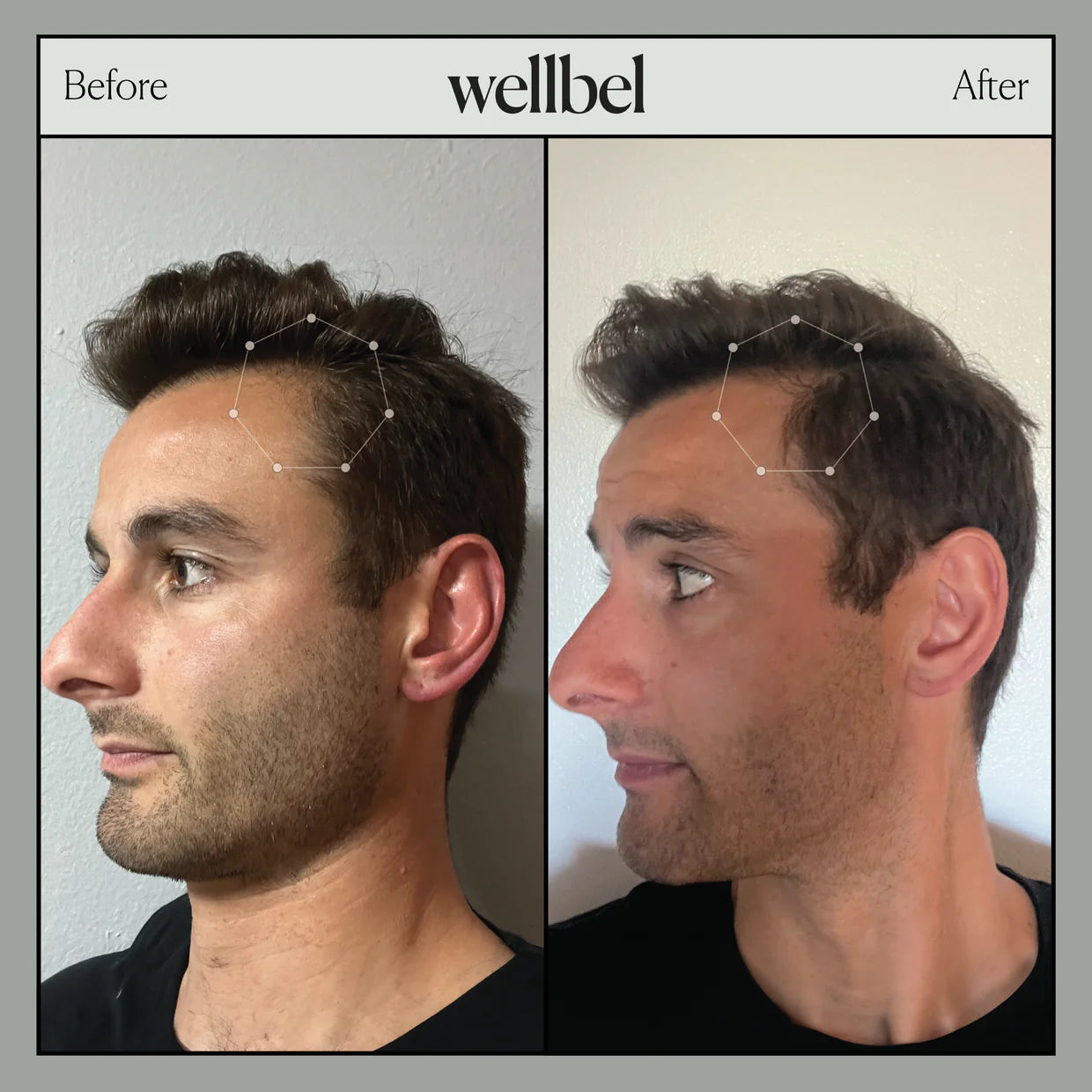 Wellbel Men