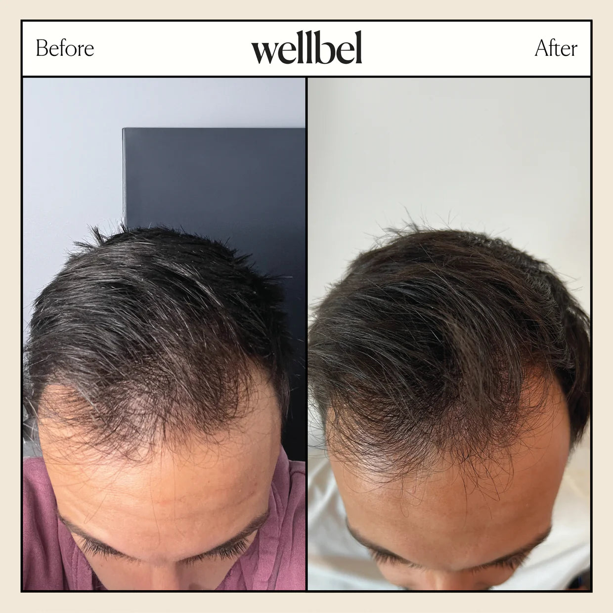Wellbel Men